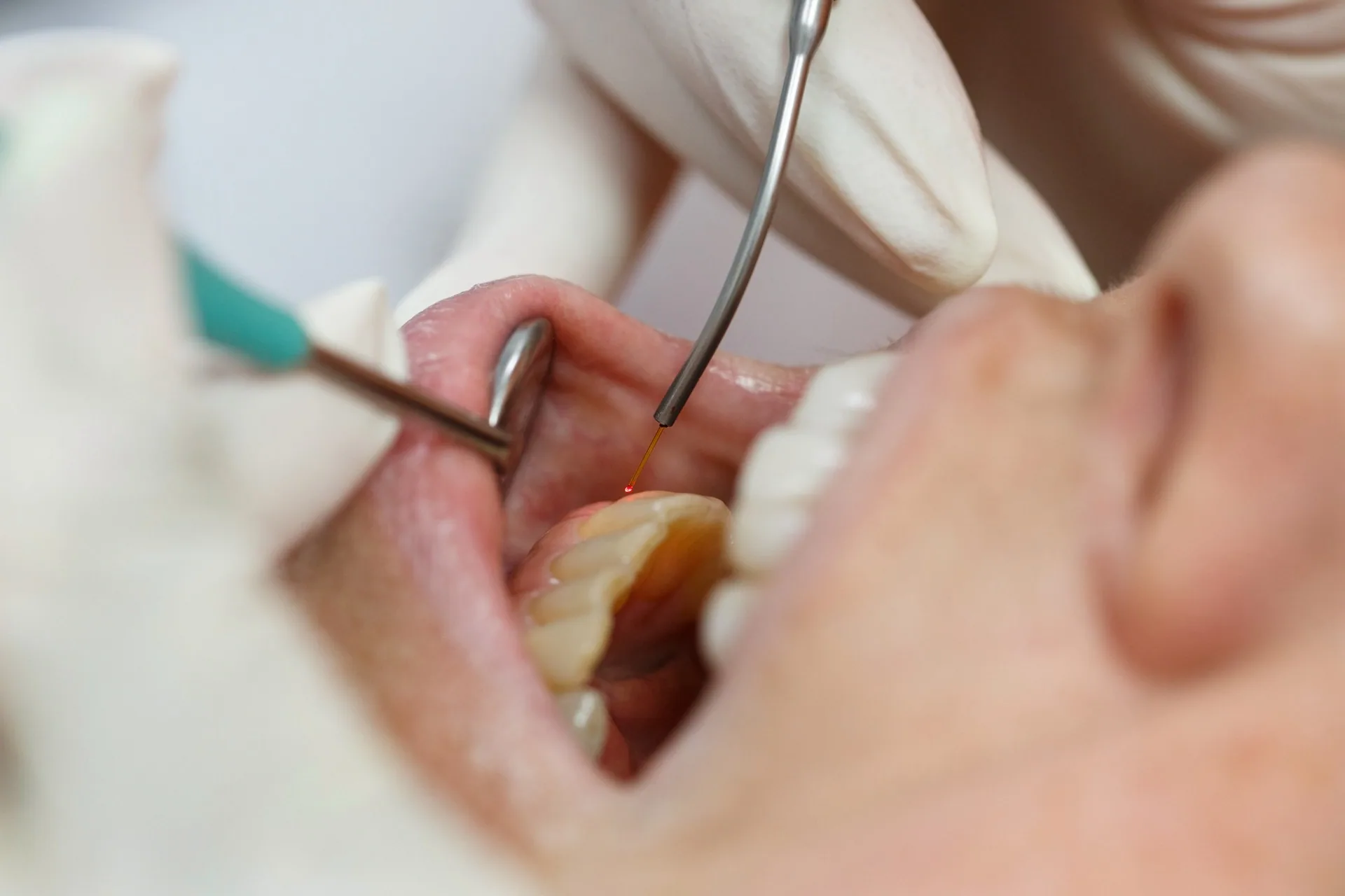 Consultation at The Hills Dental Spa