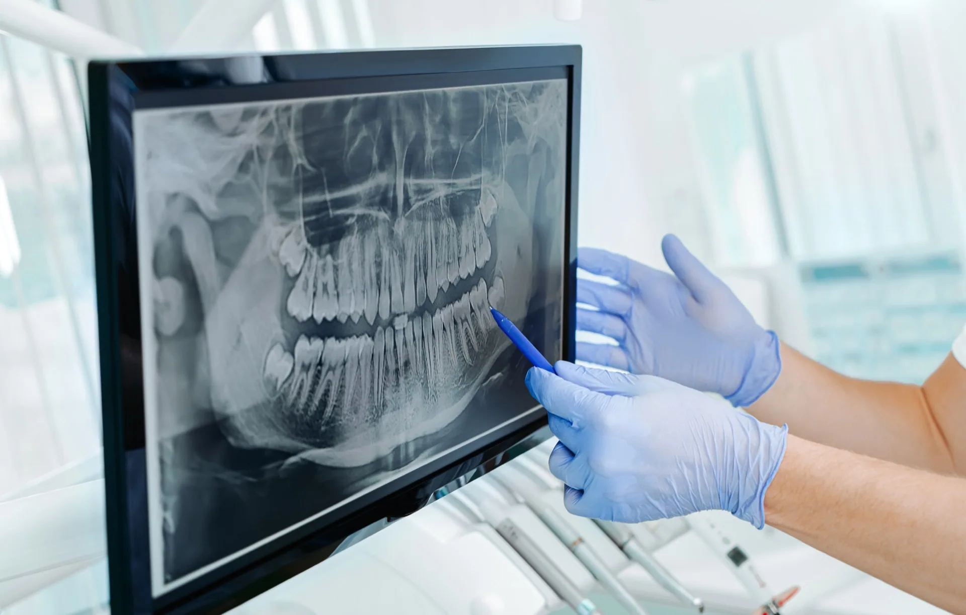 Consultation at The Hills Dental Spa