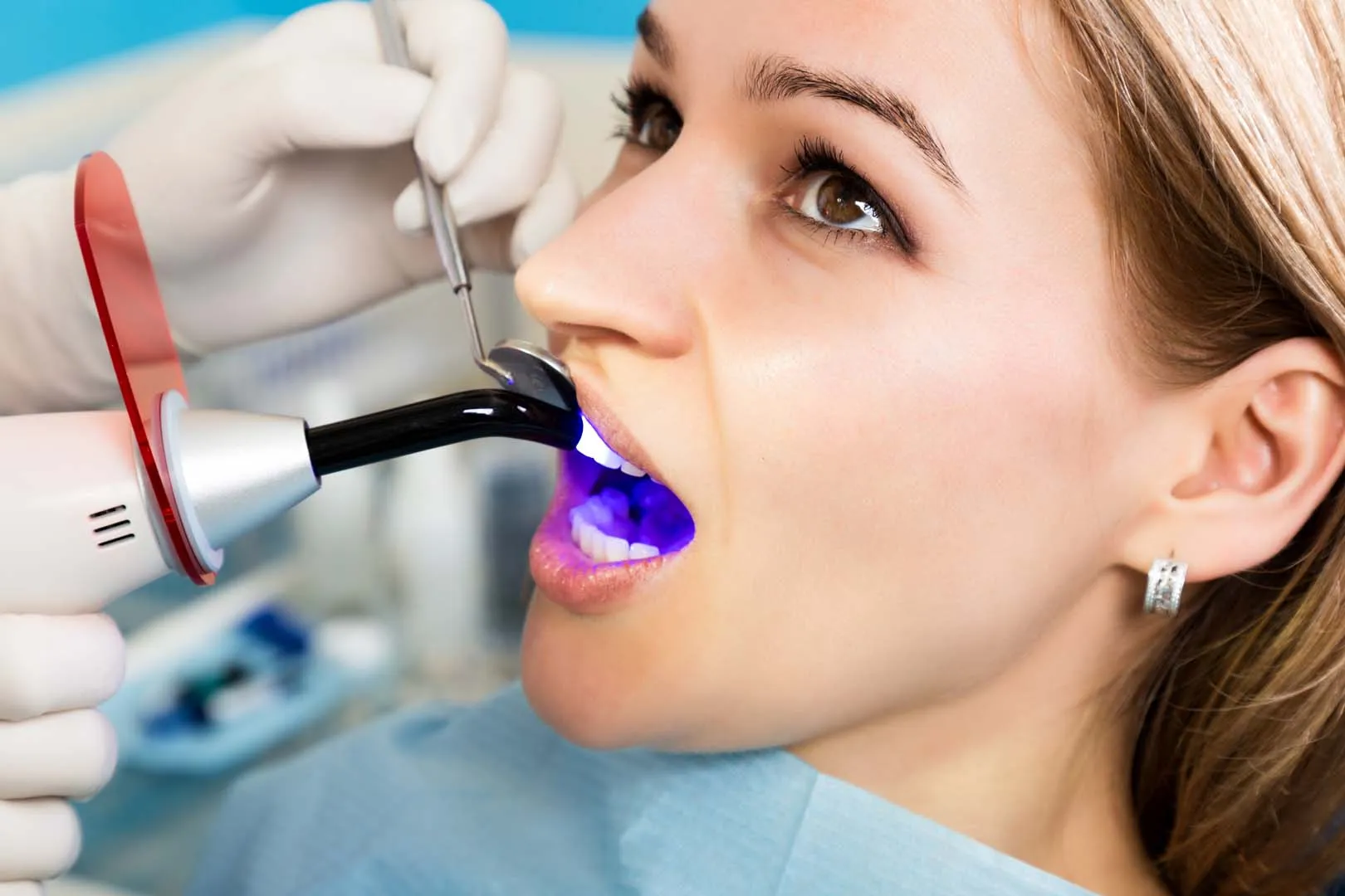 Dental Fillings at The Hills Dental Spa in Austin, TX