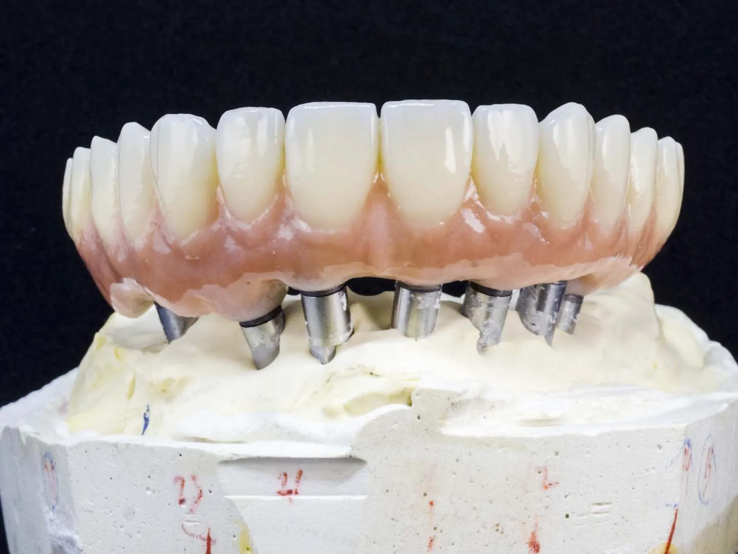 Implant-Supported Dentures at The Hills Dental Spa in Austin, TX