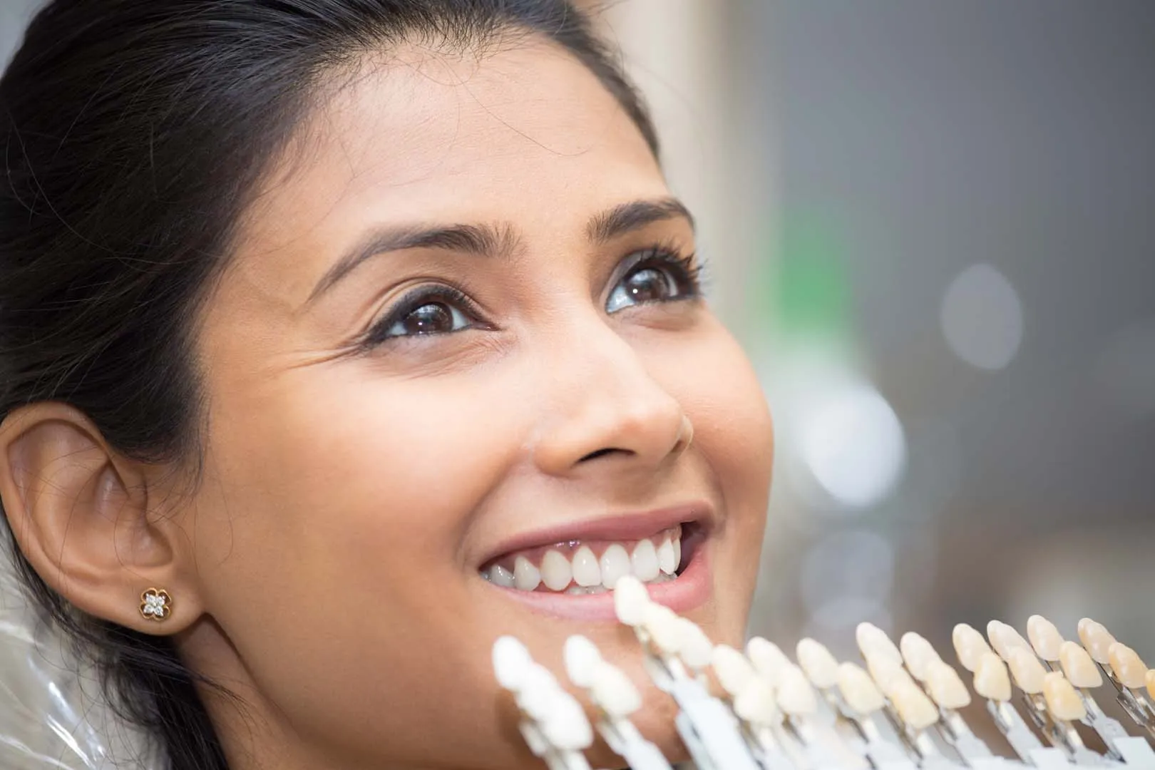 Veneer Restoration at The Hills Dental Spa in Austin, TX