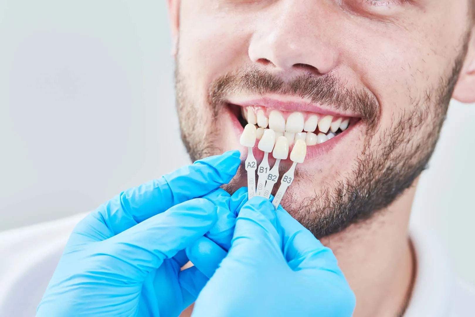 Lumineers and porcelain laminates at The Hills Dental Spa in Austin, TX