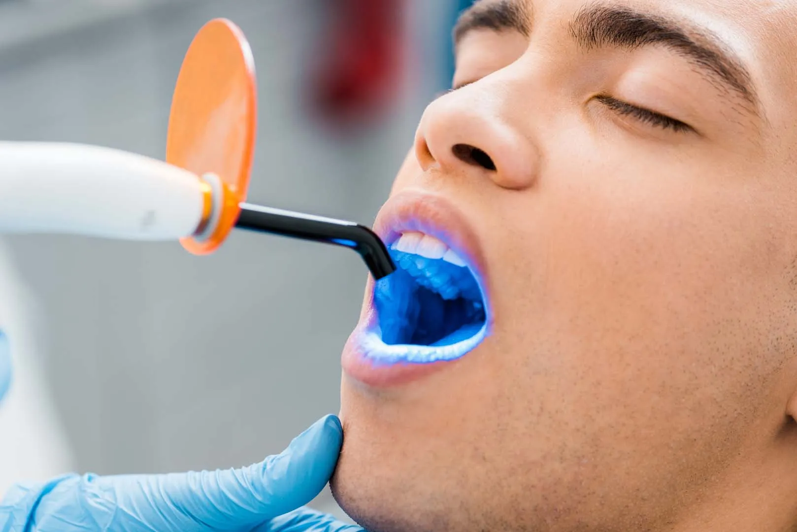 Protective dental sealants at The Hills Dental Spa in Austin, TX