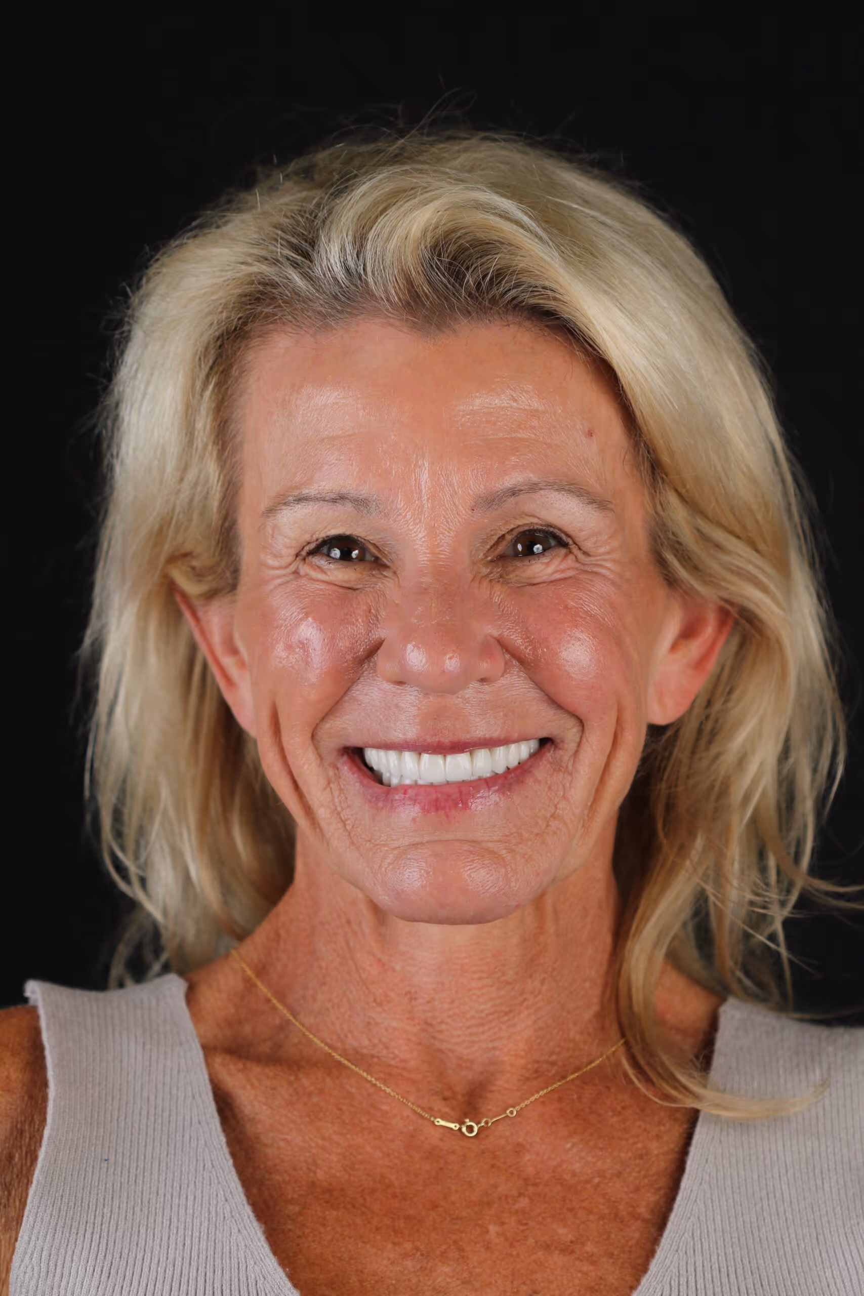 M. Ozburn After