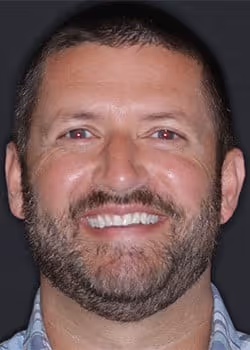 Tim Before