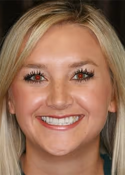 Keeli Before