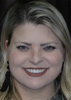 Aryca After