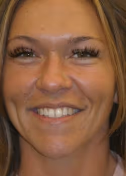 Beth Before