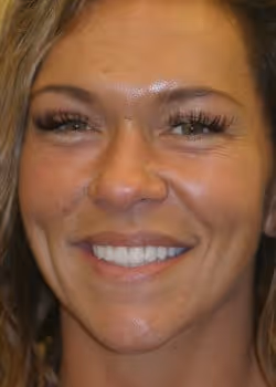 Beth After