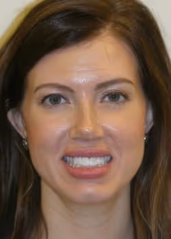 Loren Before