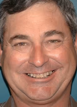 Herb Before