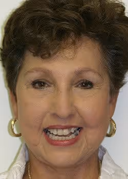 Sylvia Before