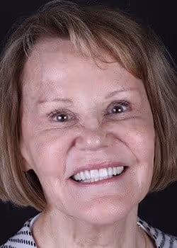 Portia After