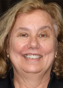Janet Before