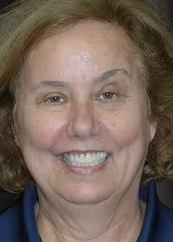 Janet After