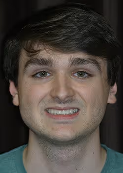 Evan After