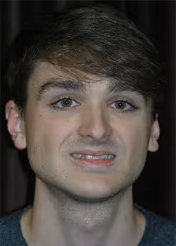 Evan Before