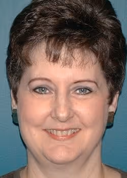 Francine Before