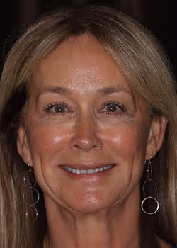 Donna Before