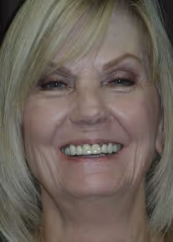 Barbara Before