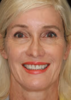 Cosmetic Dentistry Patient Before