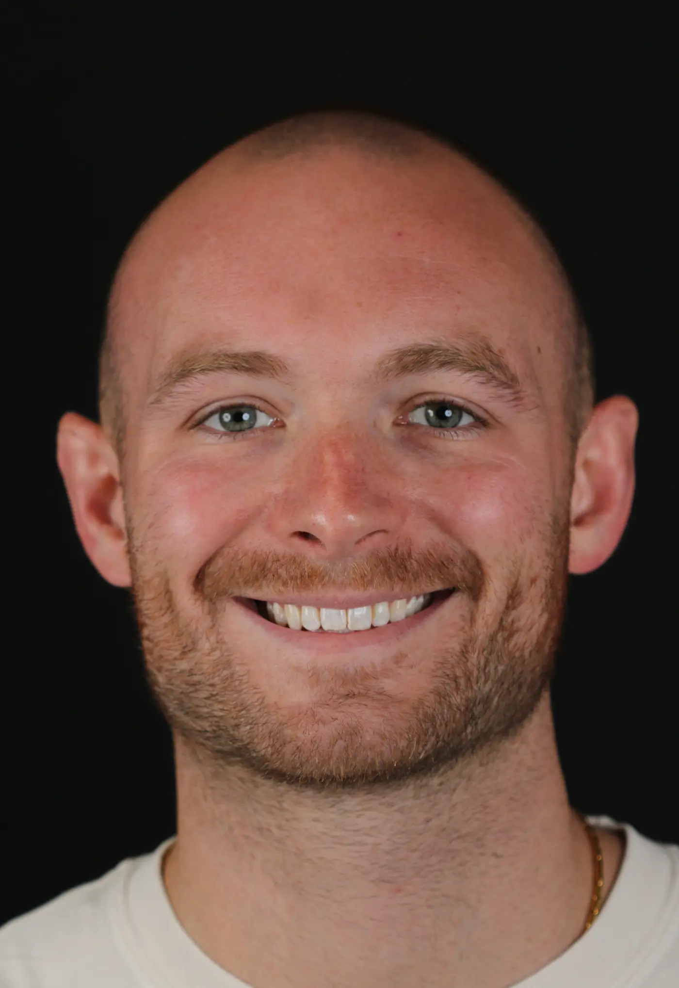 Matt Buchanan Before