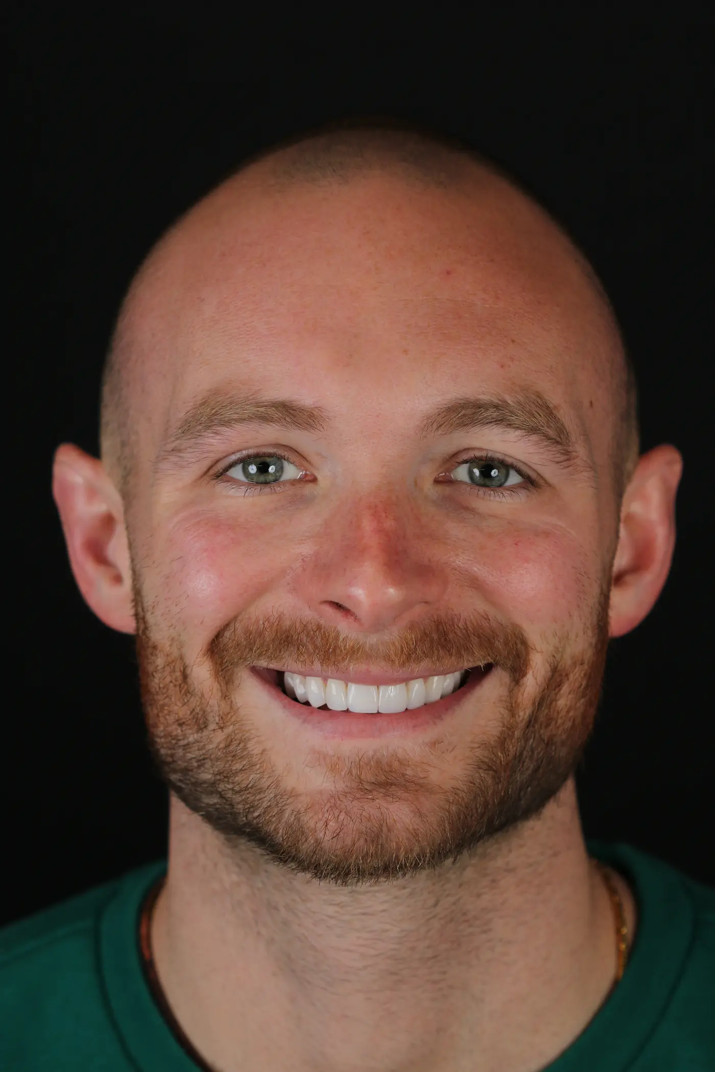 Matt Buchanan After